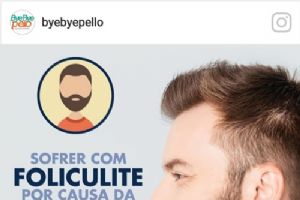 Bye Bye Pello oferece depila��o indolor est� e conquistando clientes no Shopping Popular