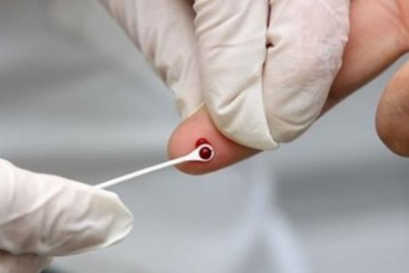 EM 2017: Quase duas pessoas foram diagnosticadas por dia com HIV